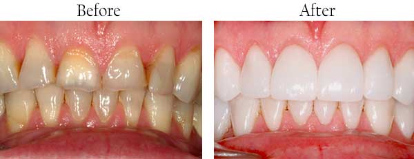 dental images 11229