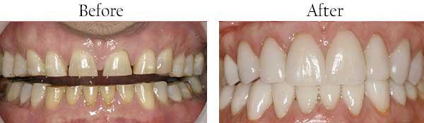 Flatlands dental images